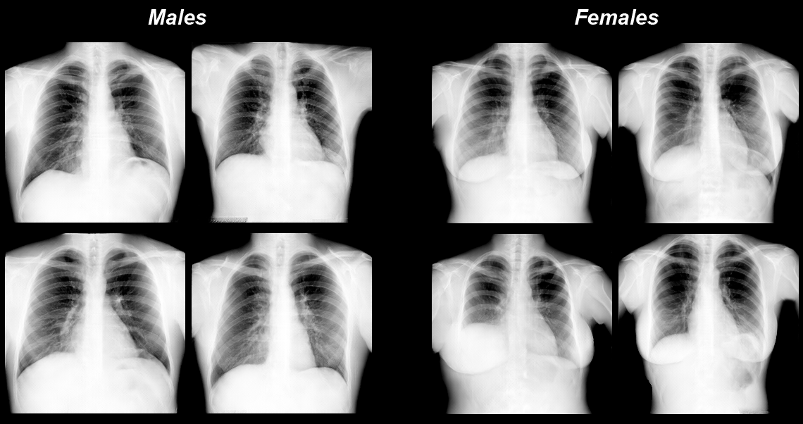 Artificial text x-ray images