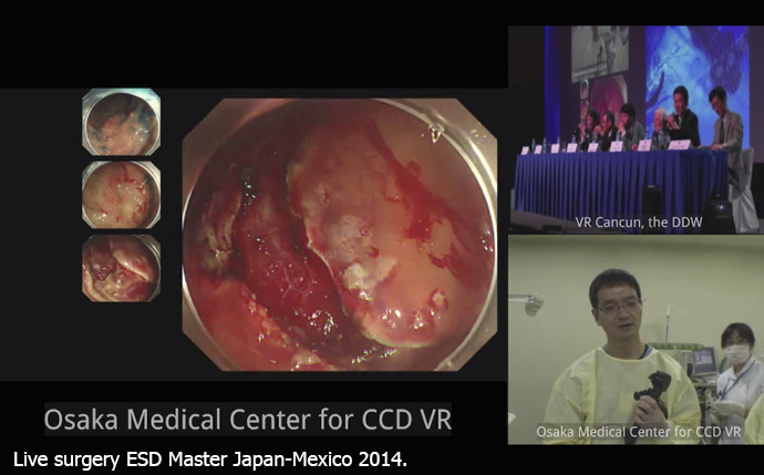 Live endoscopy proceedure